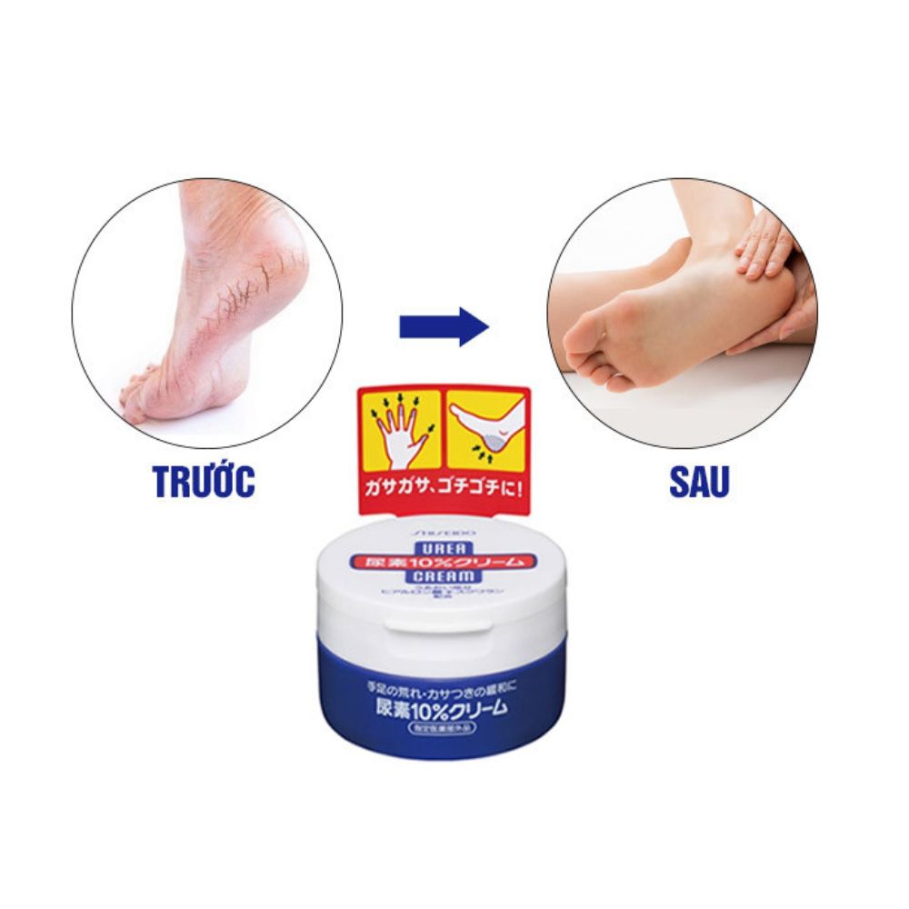 Kem trị nứt nẻ gót chân, tay Urea Shiseido Nhật Bản( Hộp 100g)